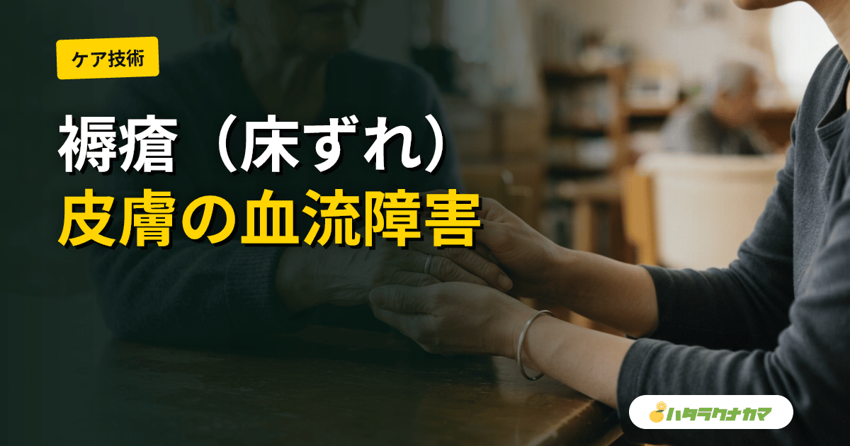 褥瘡(じょくそう・床ずれ)とは